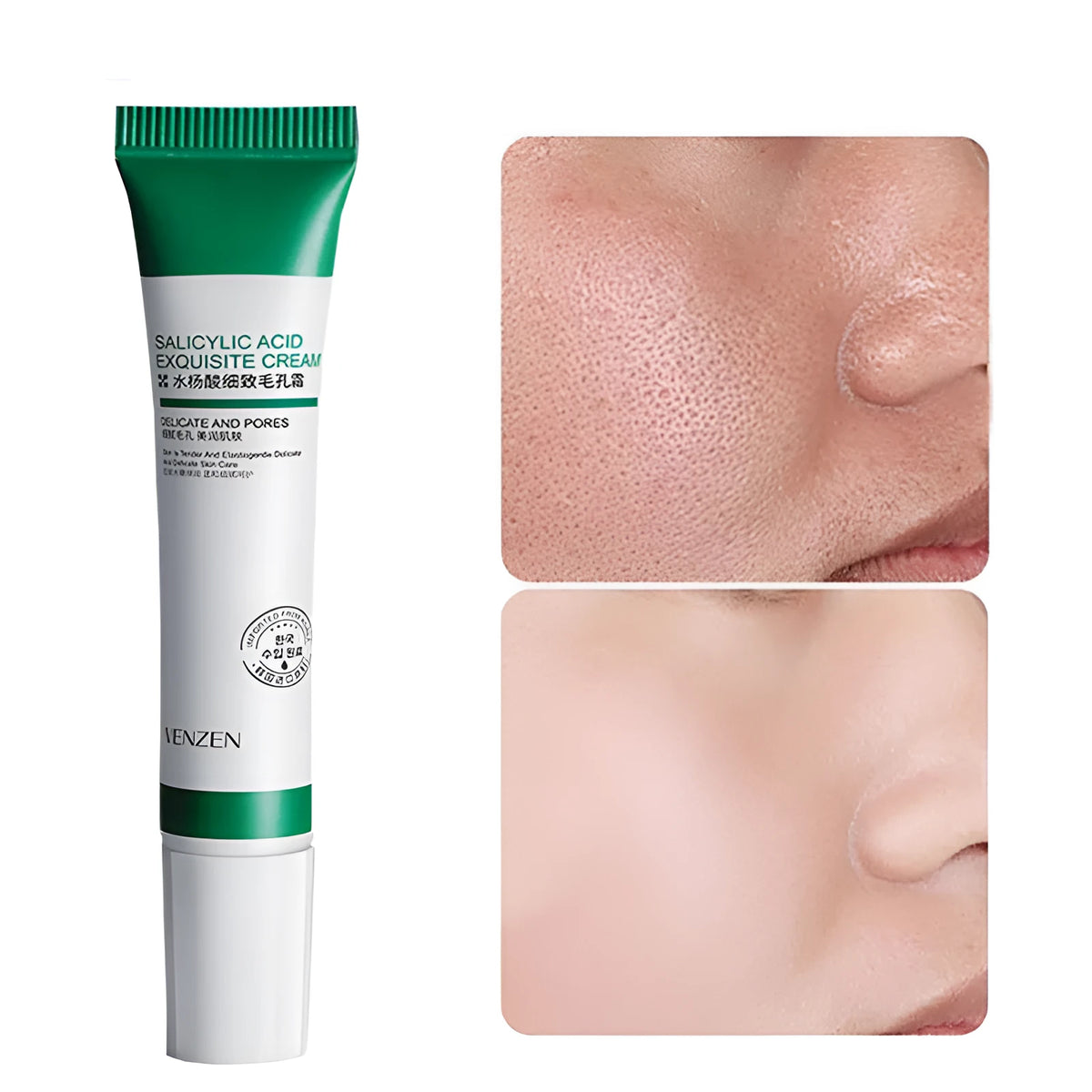 Jar of salicylic acid pore refinement cream 20g for gentle exfoliation and pore reduction