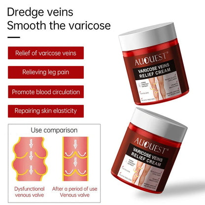 80g Chinese herbal venous cream for leg blood vessel care with three-year shelf life