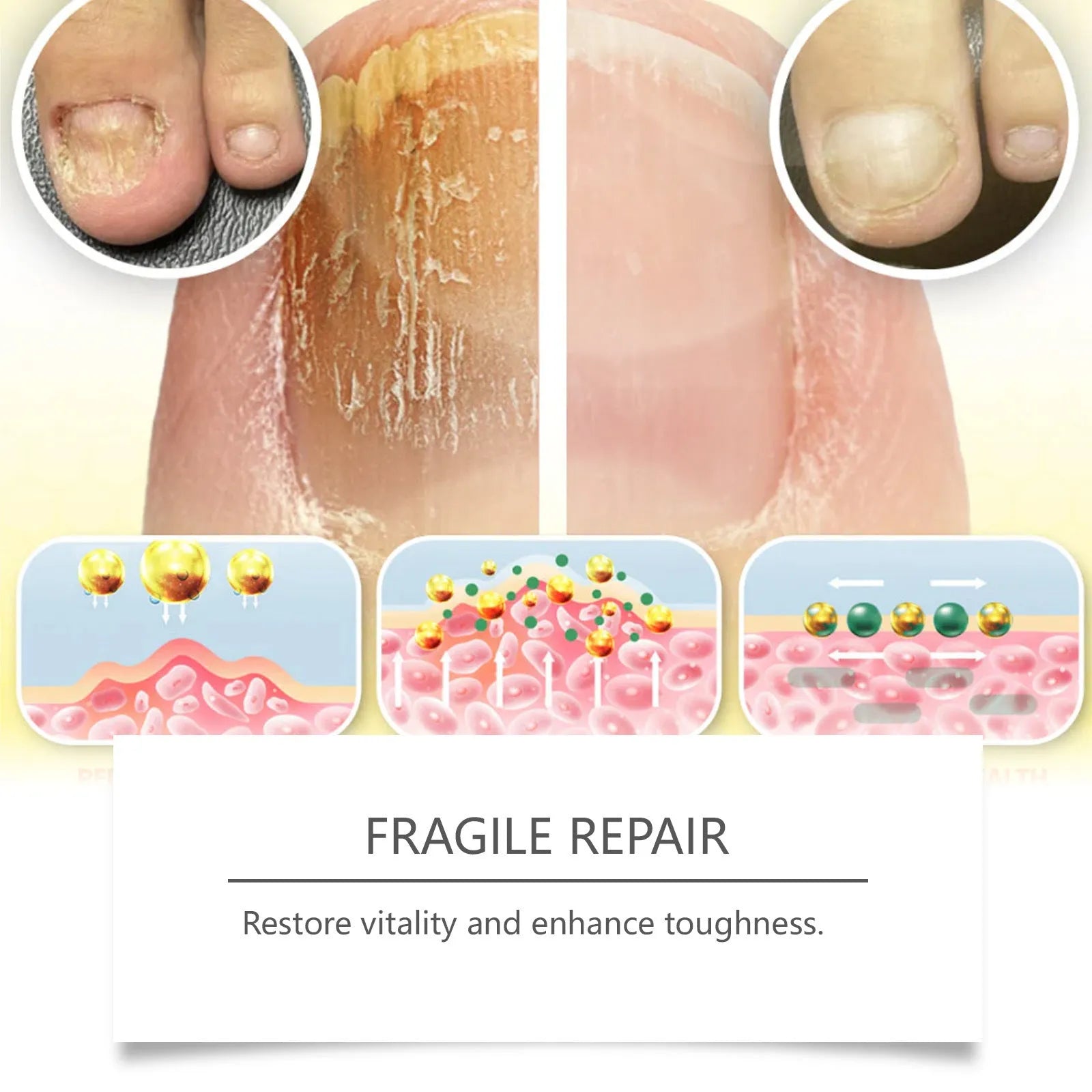 50ml bottle of nail care solution with bee venom and peppermint oil for fungal treatment