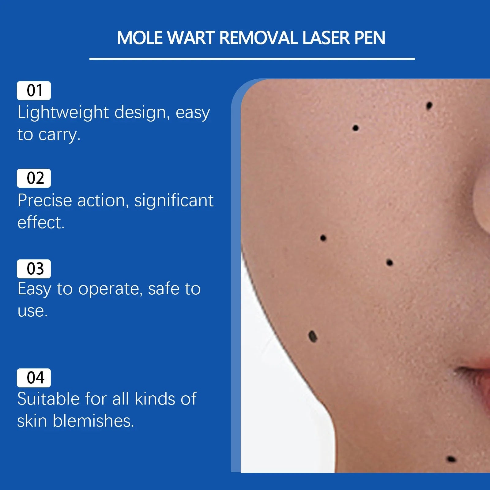 White mole wart removal laser pen with ABS plastic construction for cosmetic skin treatment