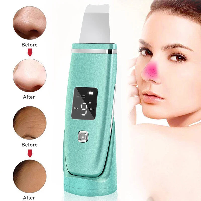 Ultrasonic Vibration Blackhead Remover with LED screen and stainless steel shovel for deep skin cleansing