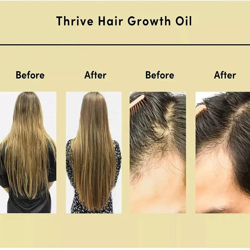 Yellow liquid rosemary essential hair oil in 60ml bottle for damaged hair treatment