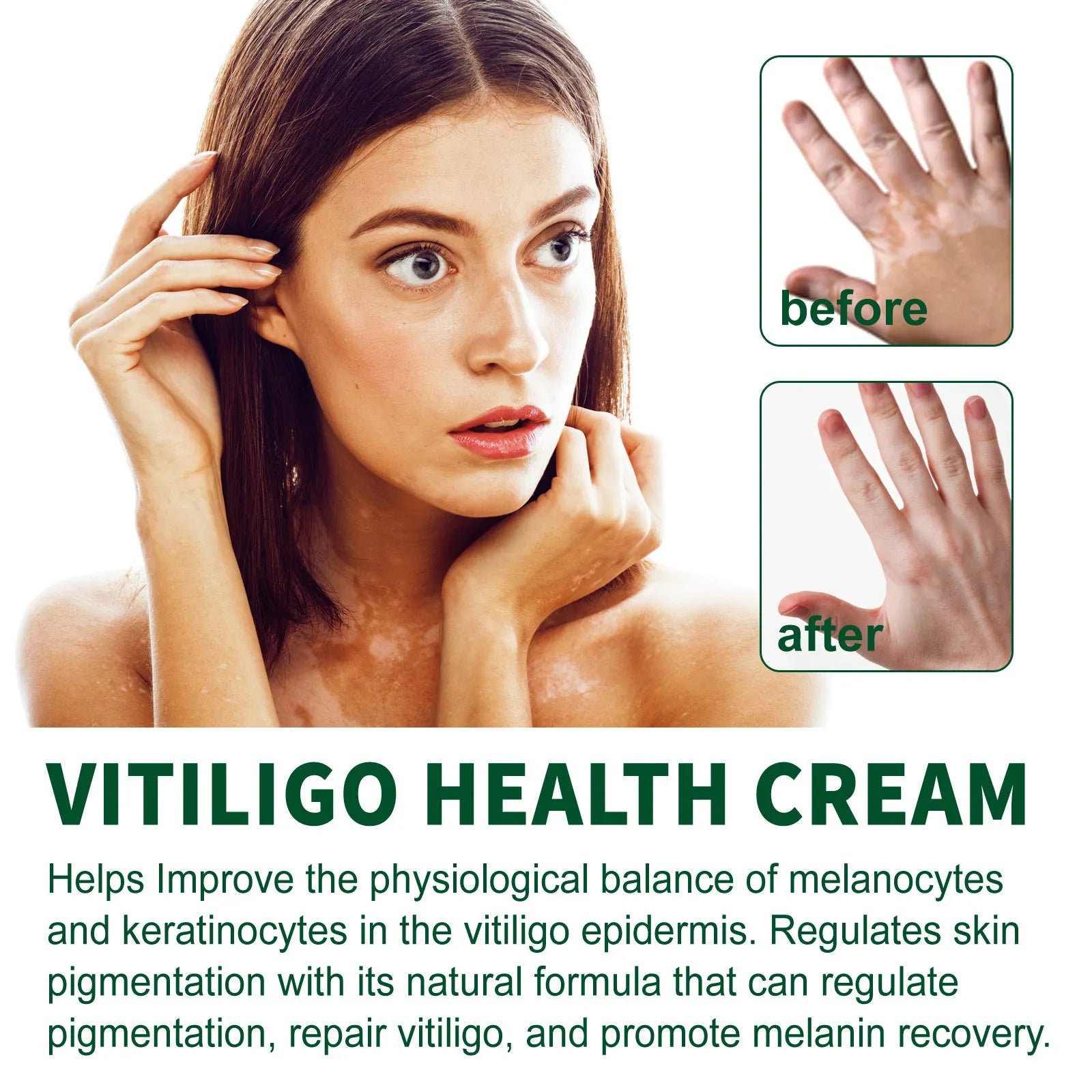 35g tube of body cleansing and moisturising cream for targeting orange peel tissue.