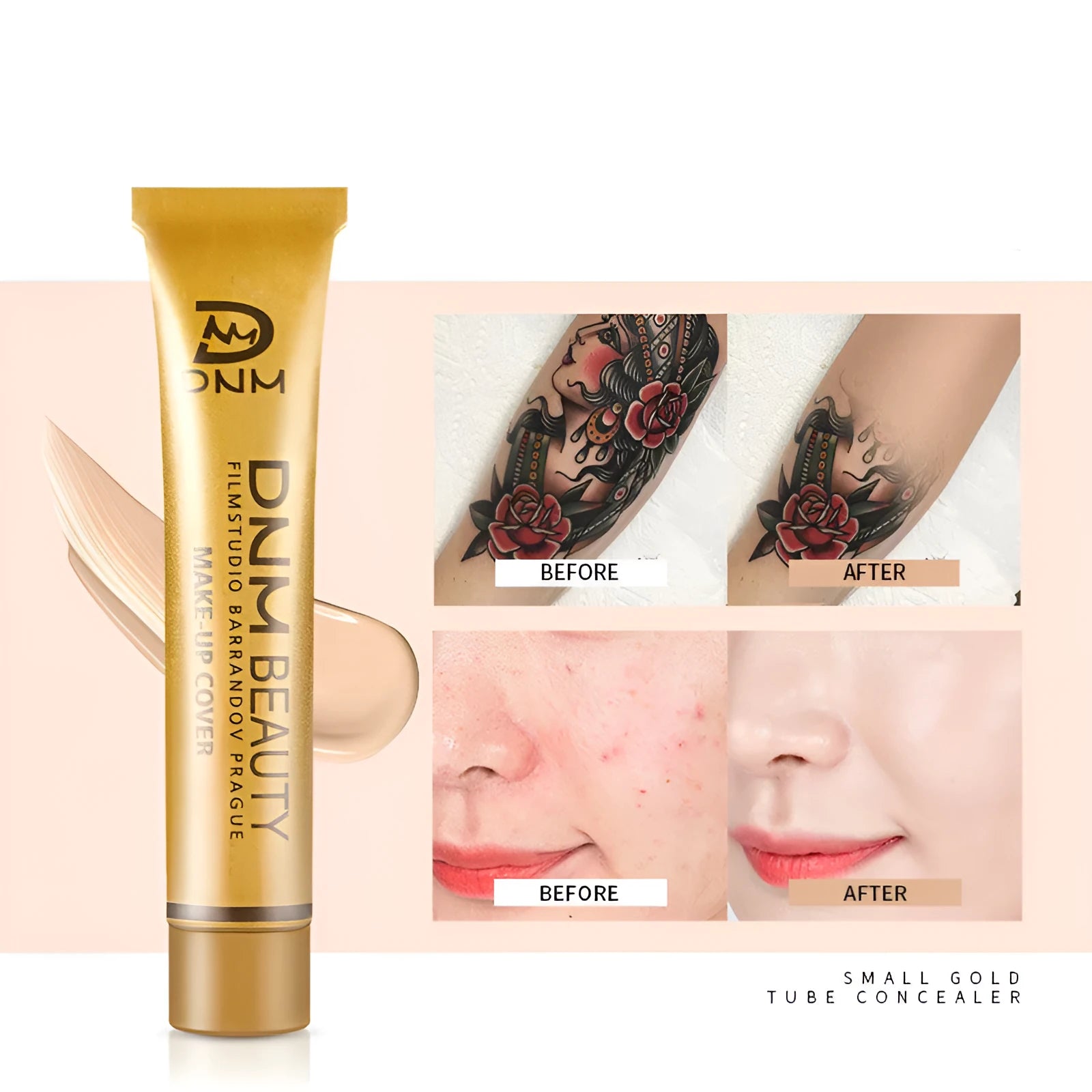 Small gold tube concealer 30g with model options for acne and freckle coverage