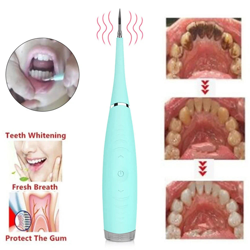 Powerful electric toothbrush cleaning tool with high-frequency vibration, IPX6 waterproof design, and ergonomic grip for effortless plaque, tartar, and stain removal