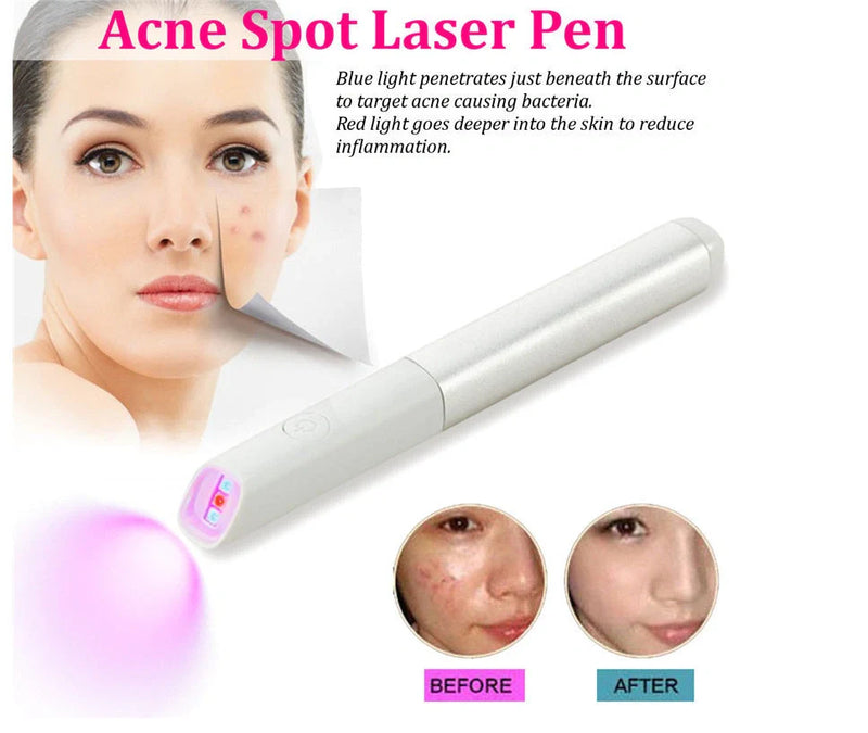 Battery-powered acne treatment device with red and blue light therapy to repair acne marks, featuring ABS and aluminium construction in silver grey or rose gold colour options