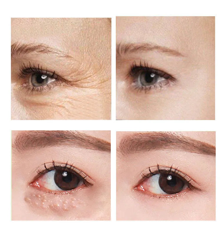 30ml airless pump bottle of hyaluronic acid and peptide eye cream for women