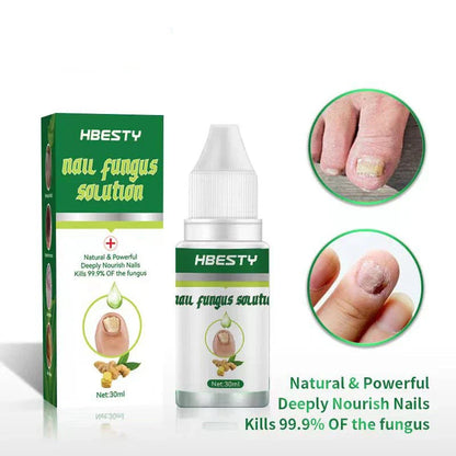 Premium Nail Fungus Treatment Gel - Clinically-Proven Formula to Eliminate Stubborn Nail Fungus and Revitalize Nails