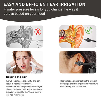 Black silicone ear washer with three nozzles and USB cable on white background