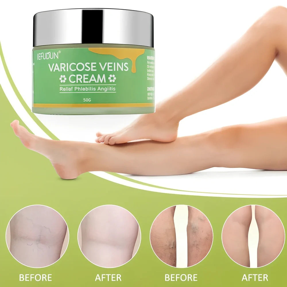 50g tube of varicose vein cream with safflower for leg circulation and pain relief, natural ingredients visible on label