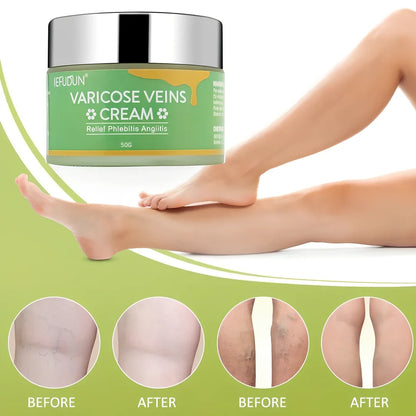 50g tube of varicose vein cream with safflower for leg circulation and pain relief, natural ingredients visible on label