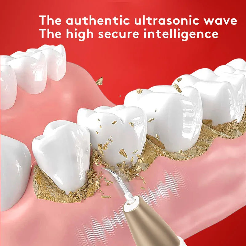 Gold ultrasonic tooth cleaner for tartar removal and stain cleaning
