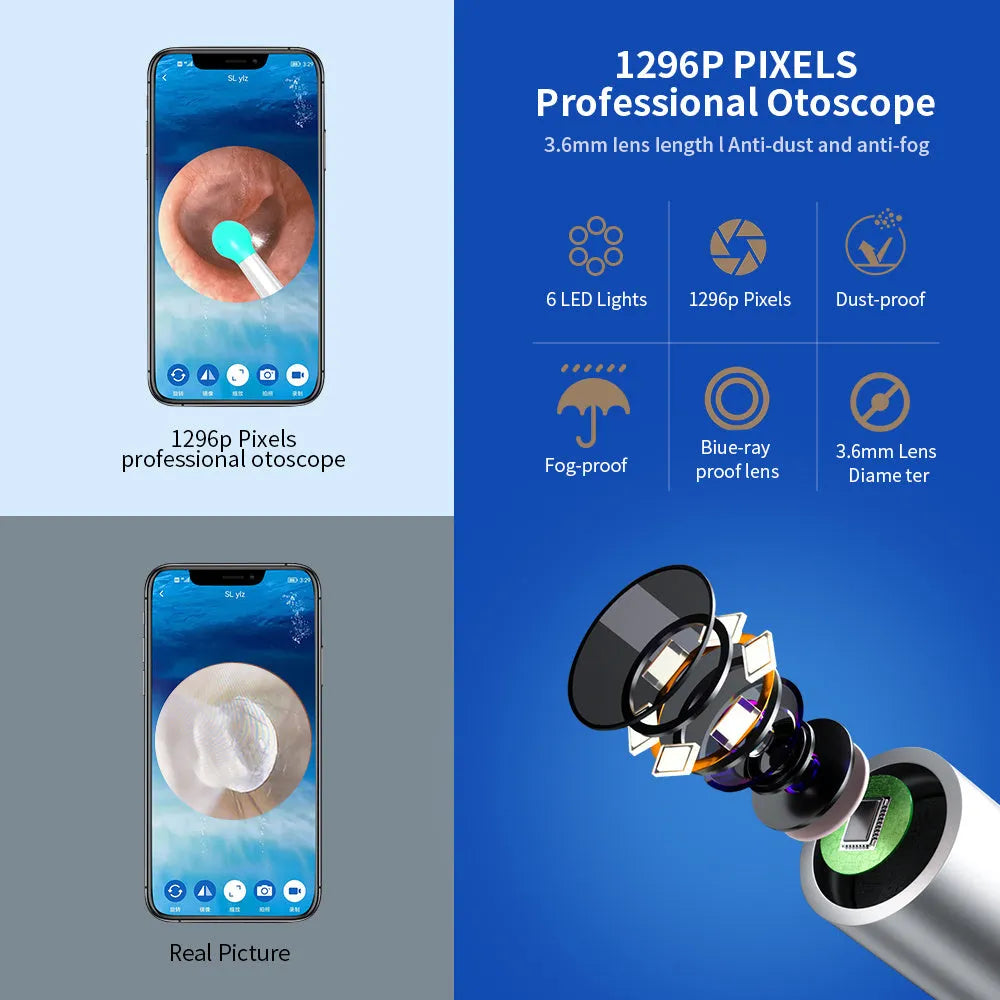 Natfire NE3 wireless otoscope ear cleaner with camera, charging cable, and spoon heads on a white background.