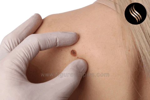 Laser Hair Growth Comb with advanced technology for rapid hair regrowth and thicker, healthier hair