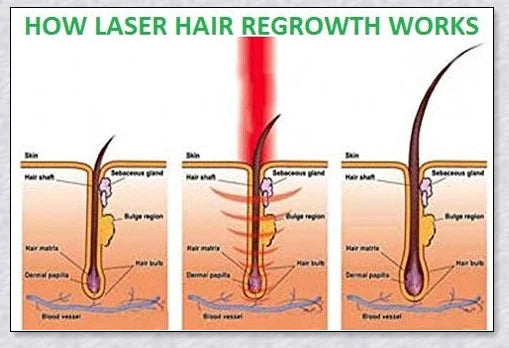 Laser Hair Growth Comb with advanced technology for rapid hair regrowth and thicker, healthier hair