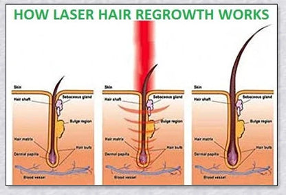 Laser Hair Growth Comb with advanced technology for rapid hair regrowth and thicker, healthier hair