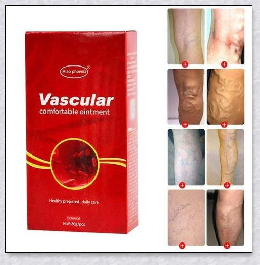 Shopfluxpro NZ Varicose Veins Treatment Cream - Effective Kiwi Remedy