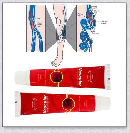 Varicose Veins Treatment Cream - Natural Chinese Herb Formula for Improved Blood Circulation and Reduced Vein Visibility