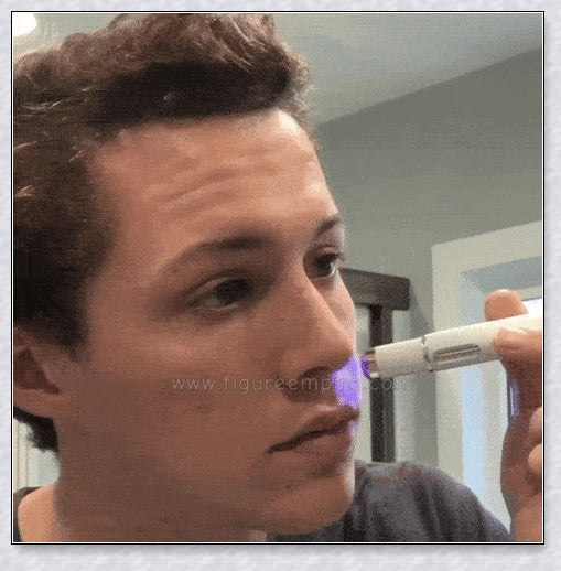 The Spots Removal Pen is a cutting-edge skincare device that uses thermal therapy and blue light to effortlessly banish dark spots, age spots, and other skin blemishes.