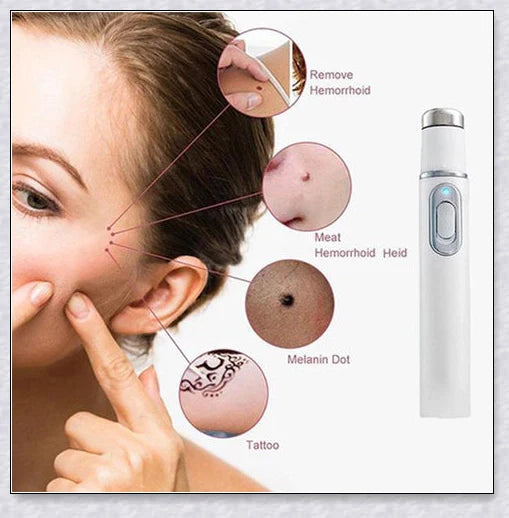 The Spots Removal Pen is a cutting-edge skincare device that uses thermal therapy and blue light to effortlessly banish dark spots, age spots, and other skin blemishes.