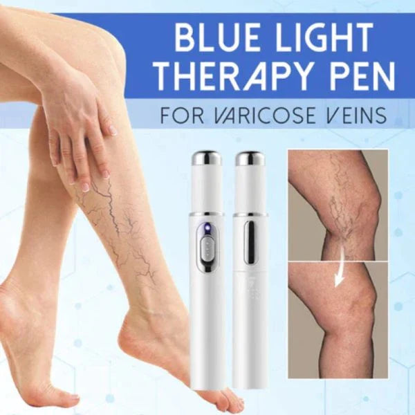 Blue light therapy pen with silicone tip for treating spider veins and acne on face, arms, and legs