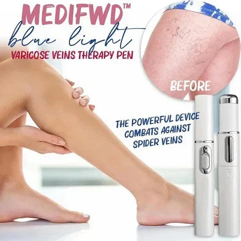 Blue light therapy pen with silicone tip for treating spider veins and acne on face, arms, and legs