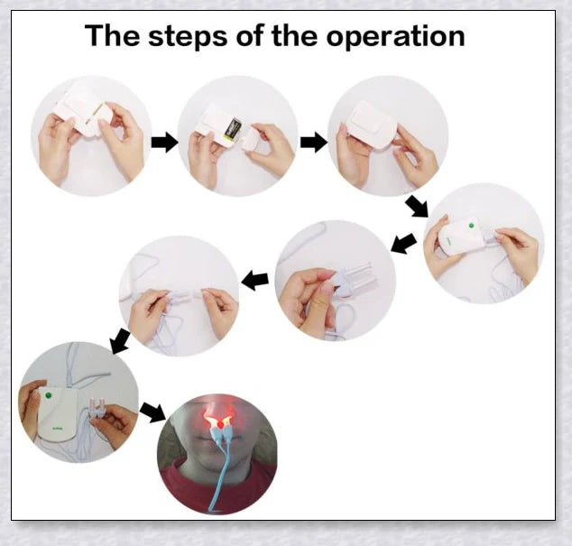 Infrared Rhinitis Therapy Device - Compact, Portable Design for Natural Sinus and Nasal Congestion Relief