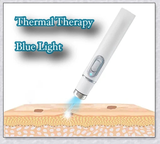 The Spots Removal Pen is a cutting-edge skincare device that uses thermal therapy and blue light to effortlessly banish dark spots, age spots, and other skin blemishes.