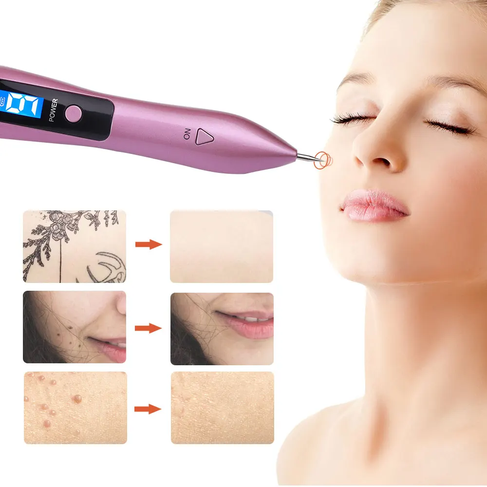 Laser Plasma Pen for Removing Skin Blemishes, Freckles, and Age Spots