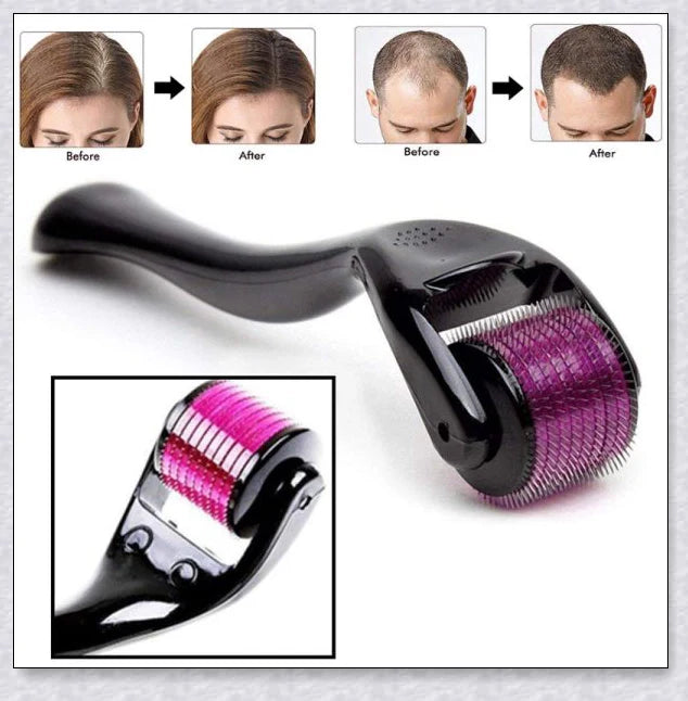 Micro-Needling Derma Roller for Hair Regrowth and Thicker, Healthier Hair