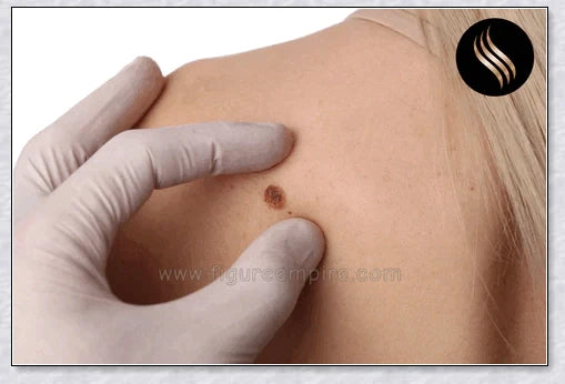 Laser Hair Growth Comb with advanced technology for rapid hair regrowth and thicker, healthier hair