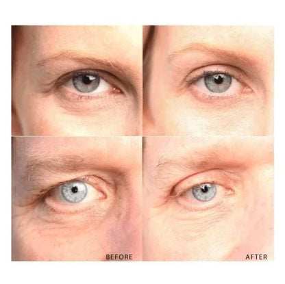 Anti-Aging Eyelid Tape with 120 pairs, providing an instant eye lift for a rejuvenated, youthful appearance