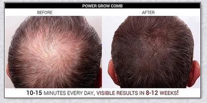 Laser Hair Growth Comb with advanced technology for rapid hair regrowth and thicker, healthier hair
