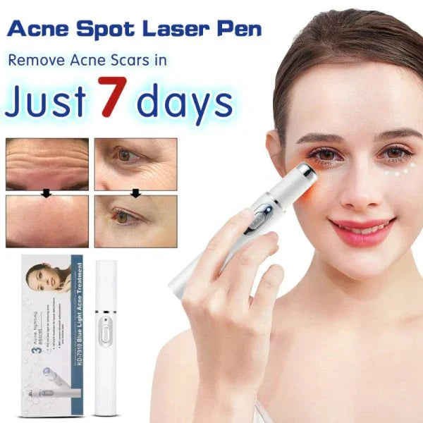 Blue light therapy pen with silicone tip for treating spider veins and acne on face, arms, and legs